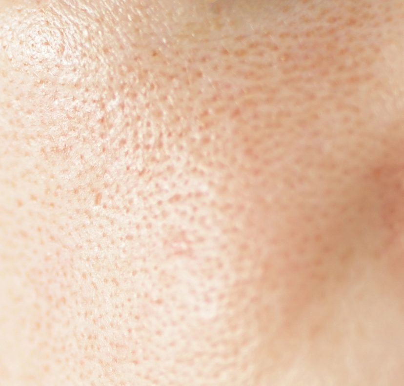 Close-up on large pores