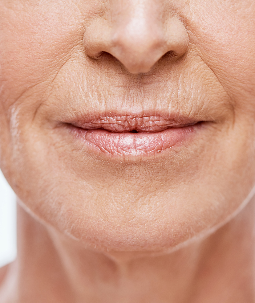 Close-up on wrinkles
