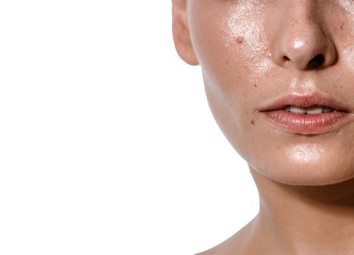 Woman with oily skin