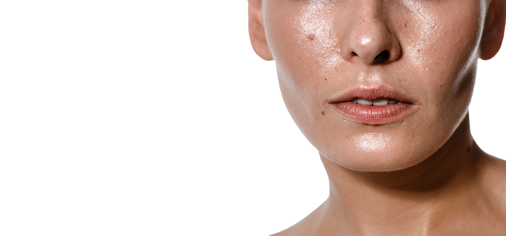 Oily Skin