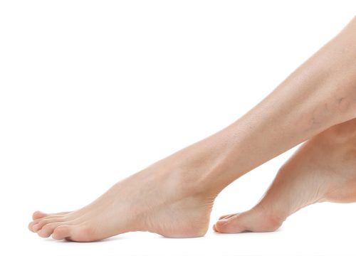 Woman's legs with visible veins